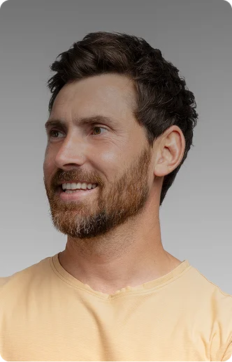 Man with full, thick hair looking to the side and smiling after hair restoration - Hair Restoration in New York, NY