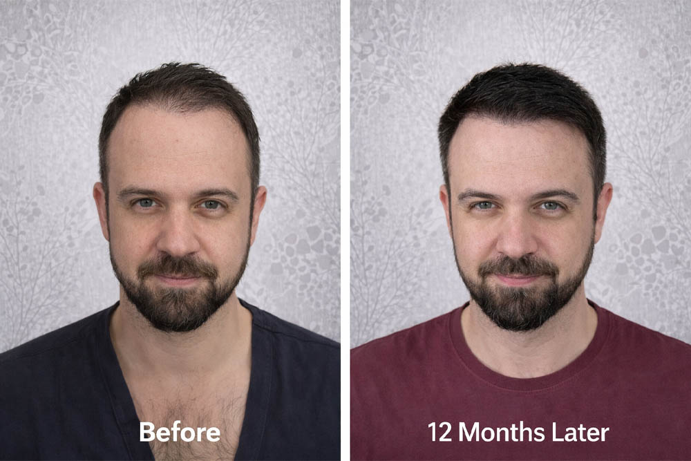 beforeafter (3)