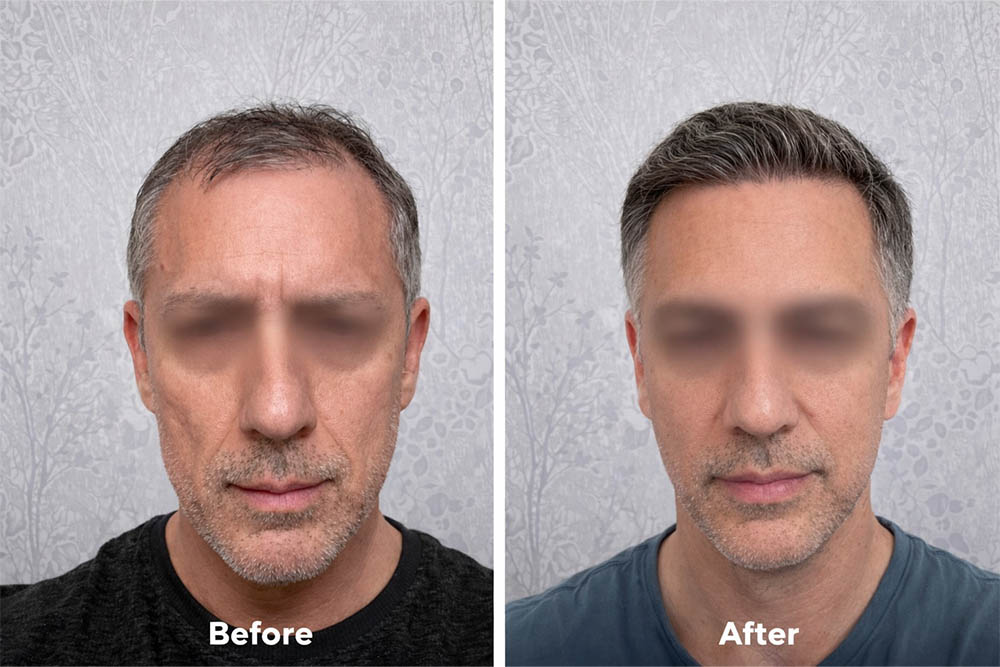 beforeafter (7)